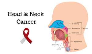 Understanding Head and Neck Cancer