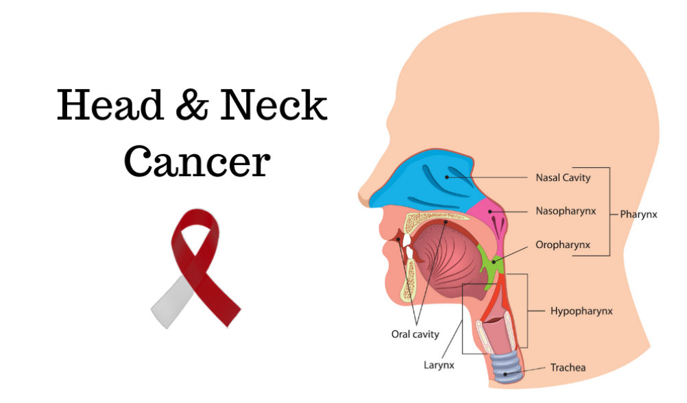 Head and Neck Cancer