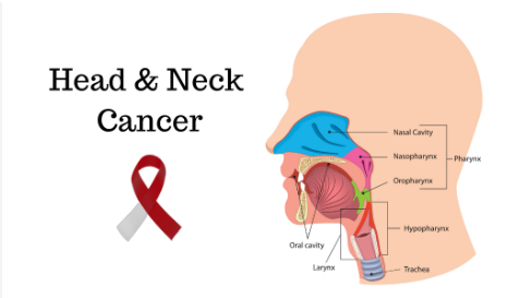 Head and Neck Cancer